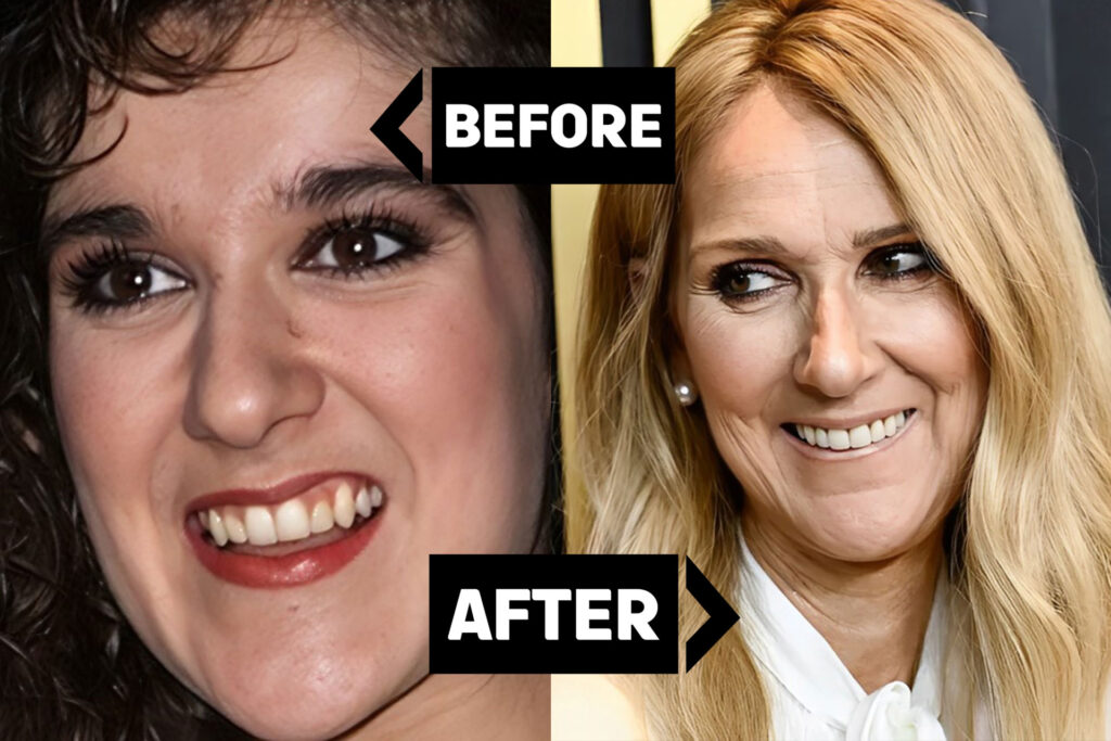 celine-dion-teeth-smiile