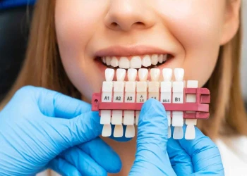 Veneer İçin Türkiye'de Kaç Gün Kalmanız Gerekiyor?