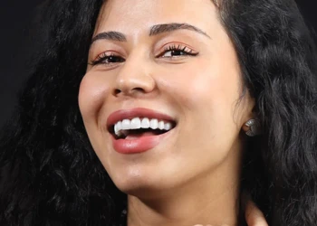 Türkiye'de Hollywood Gülüşü Ne Kadar?