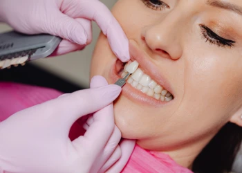 Veneerler İçin Kaç Dişe İhtiyacınız Var?