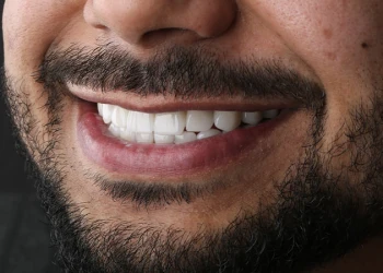 Türkiye'de Takma Dişler Ne Kadar?