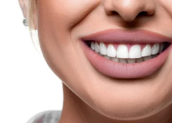 How Much Does Hollywood Smile Treatment Cost?