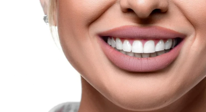 How Much Does Hollywood Smile Treatment Cost?