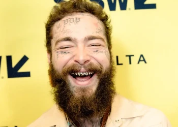 Post Malone Dişleri