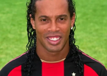 Ronaldinho Diş Dönüşümü
