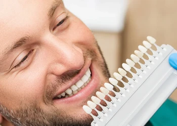 Which Country Is Best for Veneers?