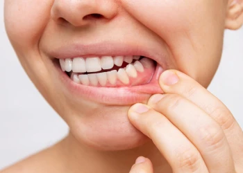 Diş Eti Çekilmesi ve Tedaviye Uygunluk