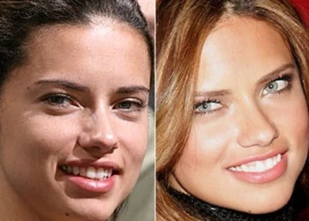 Adriana Lima Dişleri Yıl Yıl: Detaylı Bir Bakış