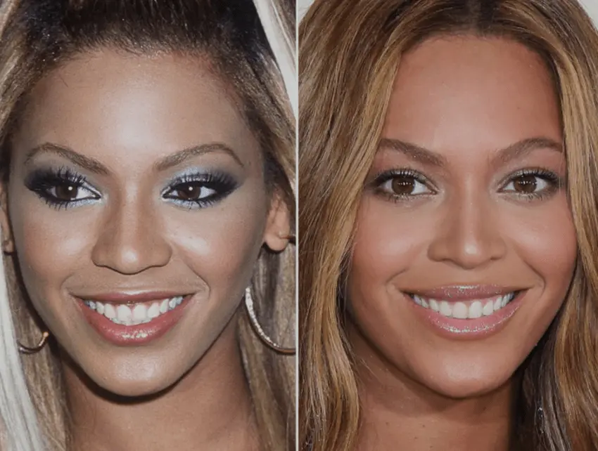 Beyonce Teeth Before and After: Smile Analysis