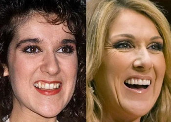 Celine Dion Dişleri Yıl Yıl: Işıltılı Bir Gülümsemenin Evrimi