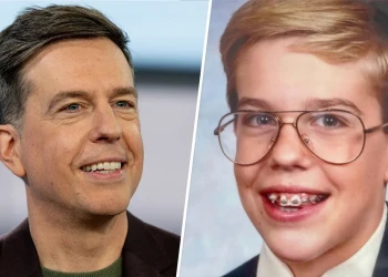 Ed Helms Dişlerinin Erken Günleri: Doğal Çekicilik Kusurla Buluşur