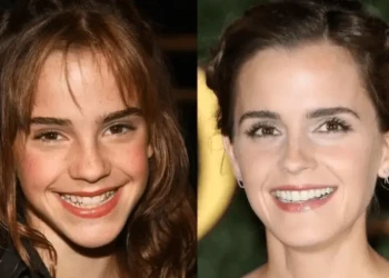 Emma Watson Dişleri: Zamansız Bir İkonun Ardındaki Büyüleyici Gülümseme
