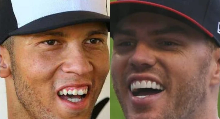 Freddie Freeman Teeth: The Science and Art Behind a Baseball Star's Smile
