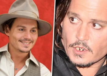 Johnny Depp Dişleri: Bir Hollywood İkonunun Gülümsemesine Yakın Bakış
