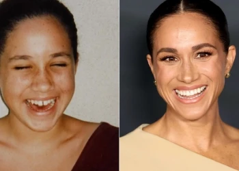 Meghan Markle Dişleri: Kraliyet Gülümsemesi Sırları