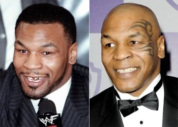 Mike Tyson Dişleri: İkonik Bir Gülümsemeye Bilimsel Bakış