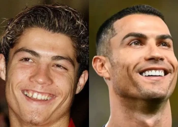 Cristiano Ronaldo Dişleri: Mükemmel Gülümsemenin Ardındaki Bilim