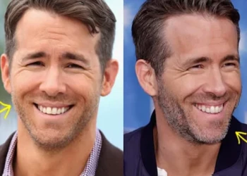 Ryan Reynolds Dişleri: Gülümsemesinin Ardındaki Bilim ve Estetik