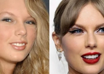 Taylor Swift Dişleri: Ünlü Güzellik Standartlarını Yeniden Tanımlayan Gülümseme
