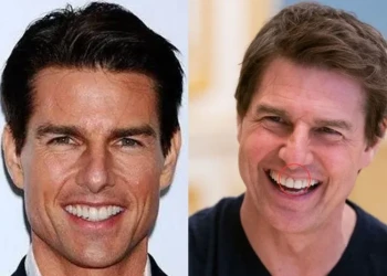 Tom Cruise'un Dişleri: Hollywood Gülümsemesinin Evrimi