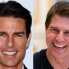 Tom Cruises Zähne: Die Entwicklung des Hollywood-Lächelns