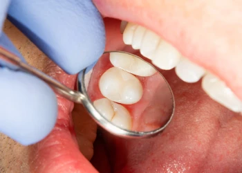 Diş Kapatma Sağlıksız mı? Yaygın Bir Diş Sorusunun Bilimsel Araştırması