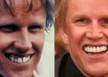 Gary Busey Dişleri Büyüleyiciliği: Bir Hollywood Hikayesi