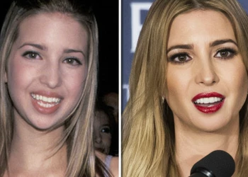 Ivanka Trump Dişleri: Modern Diş Trendlerinin Bilimsel ve Eğlenceli Keşfi