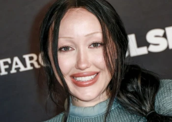 Noah Cyrus Dişleri: Öncesi ve Sonrası