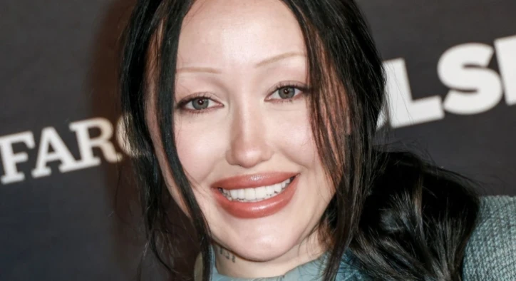 Noah Cyrus Teeth: Before and After