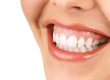 Why Do Gums Appear When Smiling?