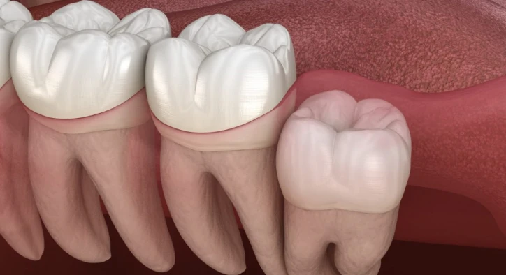 Can I Brush My Teeth Before Wisdom Teeth Removal?