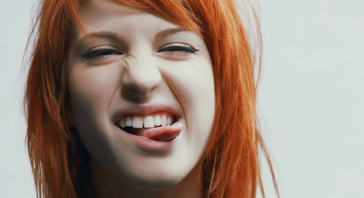 Hayley Williams Diş Dönüşümü: Öncesi ve Sonrası