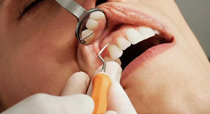 How to Find a Good Dental Implant Surgeon?
