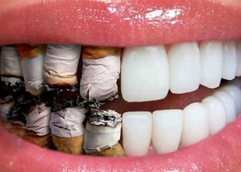What Are the Effects of Smoking on Bleeding Gums?