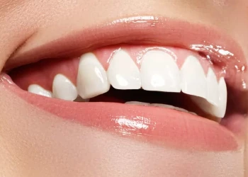 Does a Hollywood Smile Cause Bad Breath? A Dentist’s Guide