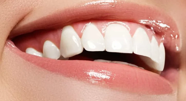 Does a Hollywood Smile Cause Bad Breath? A Dentist’s Guide