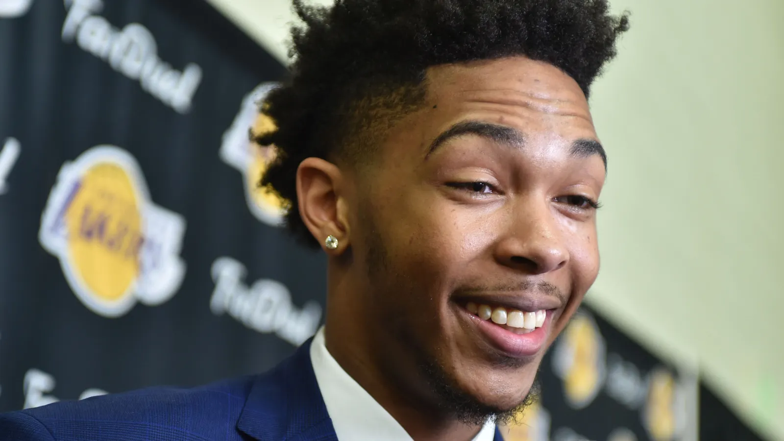 Brandon Ingram Teeth Before and After: A Close Look at His Dental Makeover