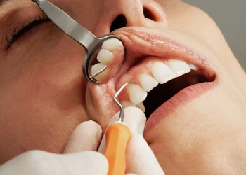 What is Included in a Dentist Checkup?