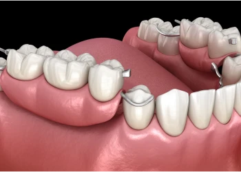 Was ist ein Dental Flipper Code?