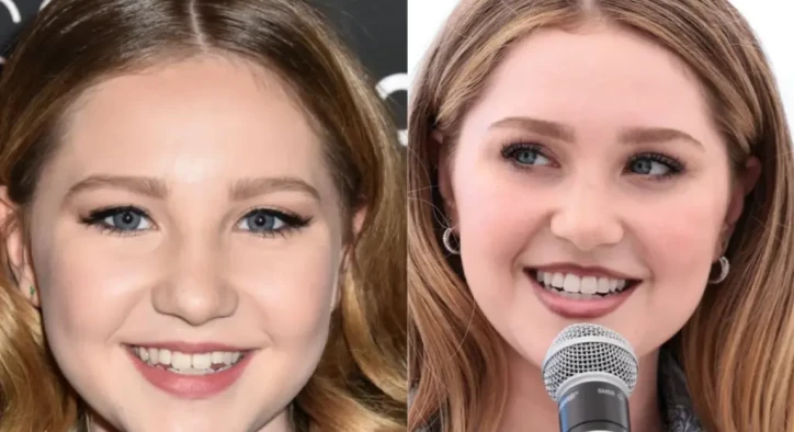 Ella Anderson Teeth Transformation: Before and After