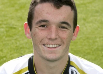 John McGinn Teeth Transformation: Before and After