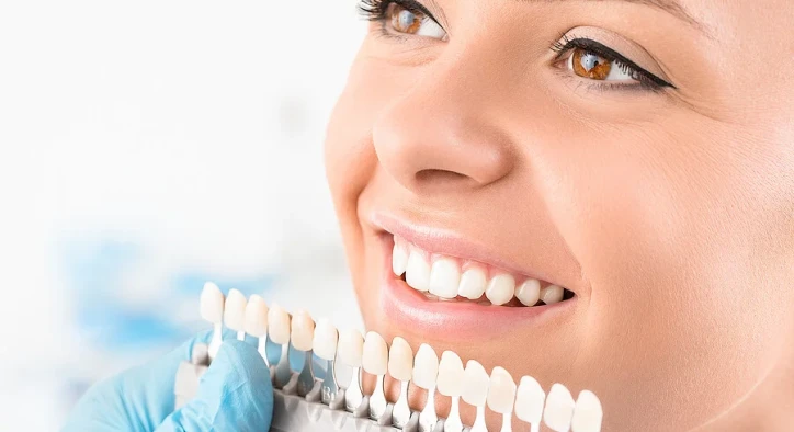 Laminate Teeth Veneer Guide: Costs, Procedure & Results
