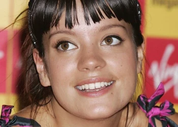 Lily Allen Teeth Transformation: Before and After