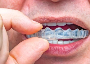 Что такое код зубной каппы для ночной защиты?