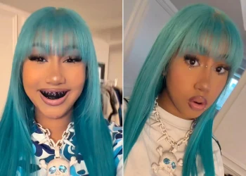 North West Teeth Journey: Braces, Diamonds, and Black Smile