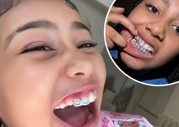 North West Tanden Reis: Beugels, Diamanten en Black Smile