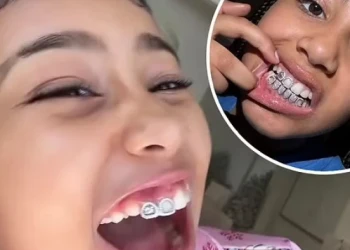 North West Teeth Journey: Braces, Diamonds and Black Smile