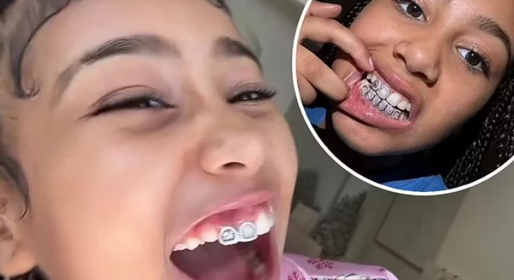 North West Tanden Reis: Beugels, Diamanten en Black Smile