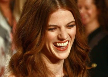 Transformacija zob Rose Leslie – Prej in Potem